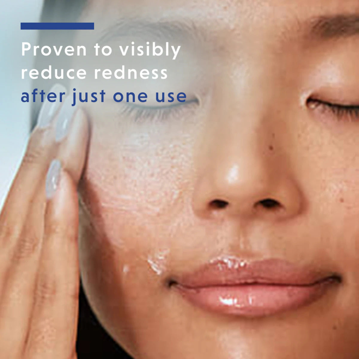 EltaMD® Skin Recovery Serum
