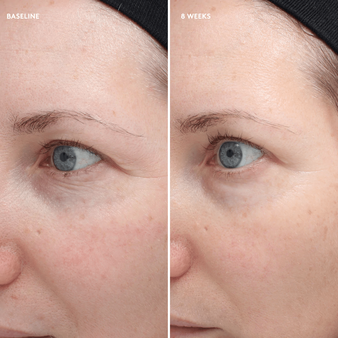 Colorescience® Total Eye® Firm & Repair Cream